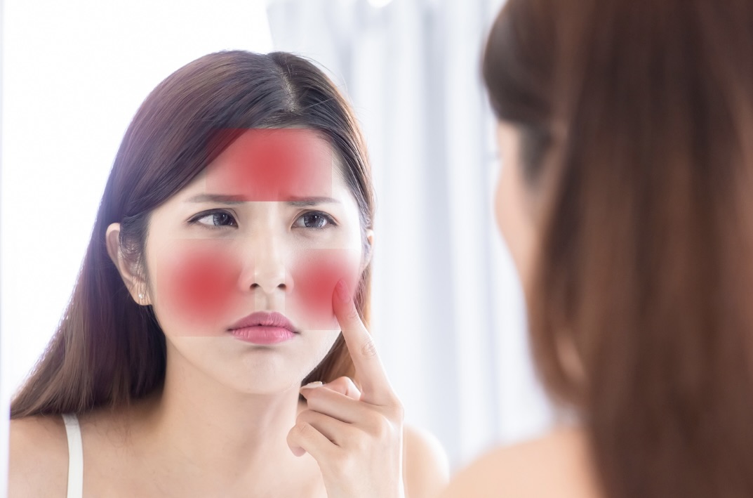 赤ら顔で悩む女性