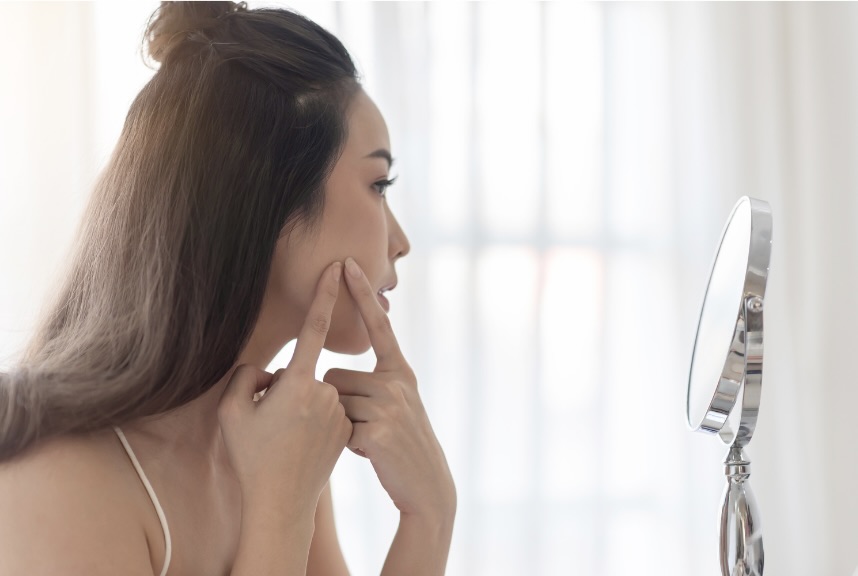 肌に悩む女性